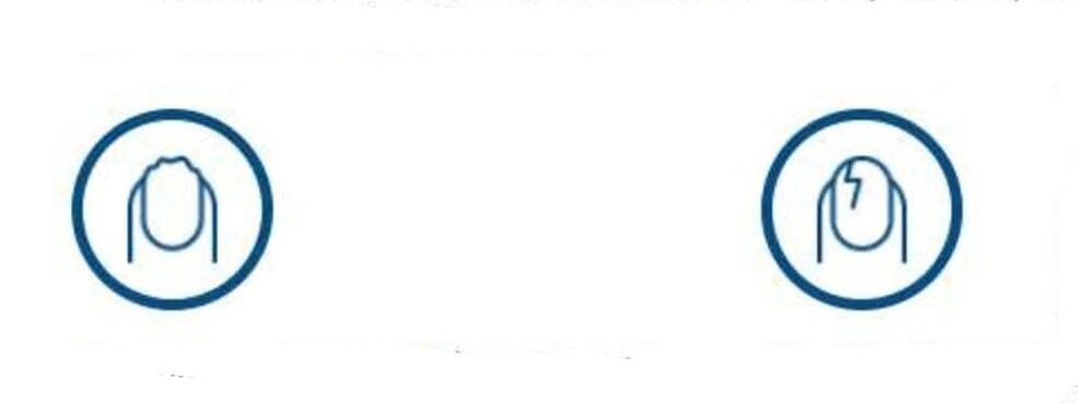 mantar enfeksiyonu nedeniyle tırnakların deformasyonu